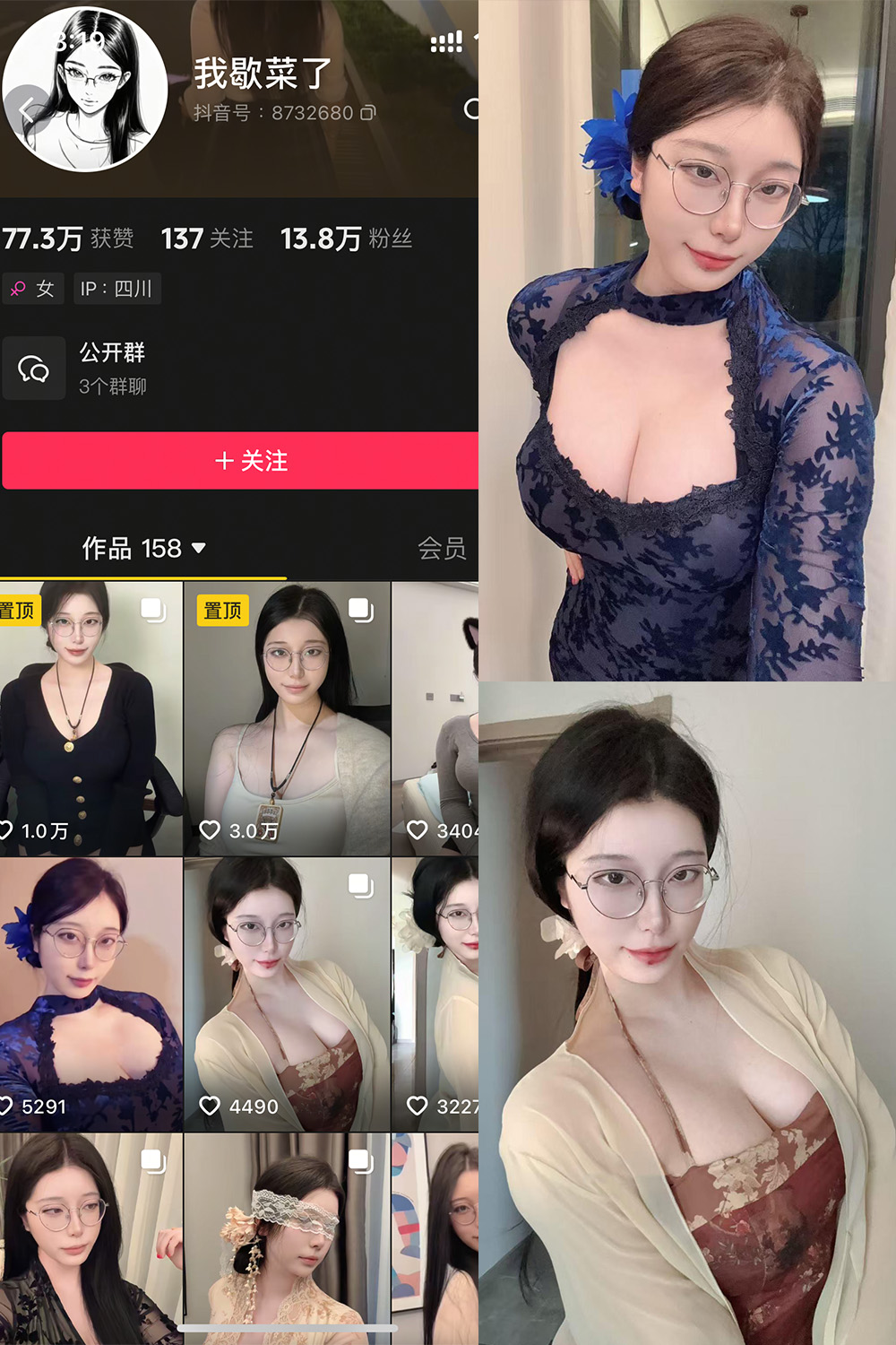 抖音 我歇菜了 微密圈 NO.001期 【10P】最新至：2025.4.19-微私密圈-全网最全抖音网红铁粉写真空间